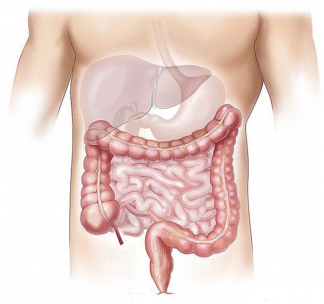 Probiotikum Leaky-Gut-Syndrom
